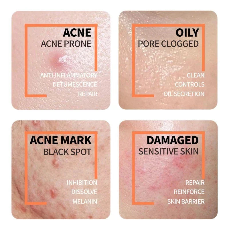 Niacinamide + Glycolic Acid Duo (Solve All Your Skin Problems)