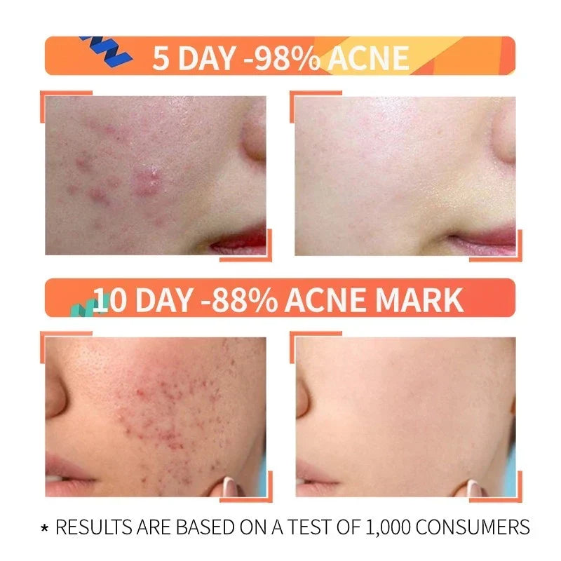 Niacinamide + Glycolic Acid Duo (Solve All Your Skin Problems)