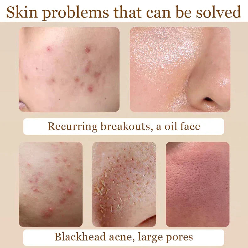 Niacinamide + Glycolic Acid Duo (Solve All Your Skin Problems)