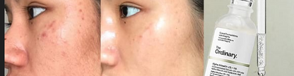The Ordinary Glycolic Toning Solution 7% | Natural Moisturizing Factors + HA | Alpha Arbutin 2%+ HA